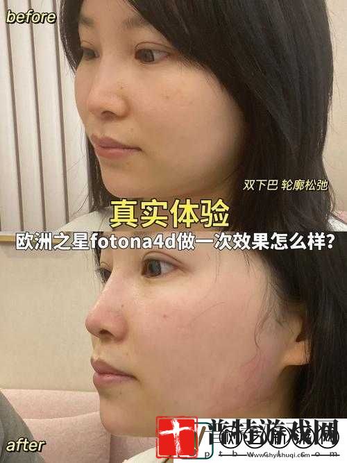欧洲之星